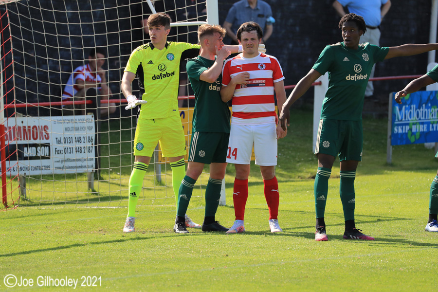 Bonnyrigg Rose v Celtic B Bonnyrigg Rose v Celtic B