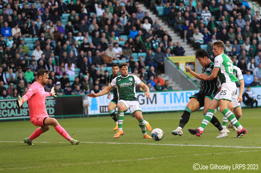 Hibernian v Celtic