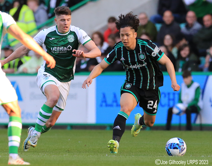 Hibernian v Celtic