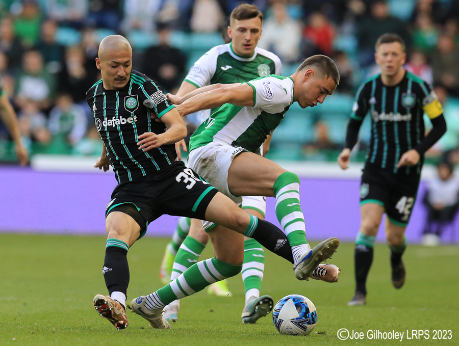 Hibernian v Celtic