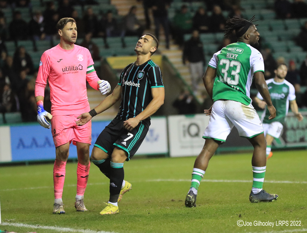 Hibernian v Celtic